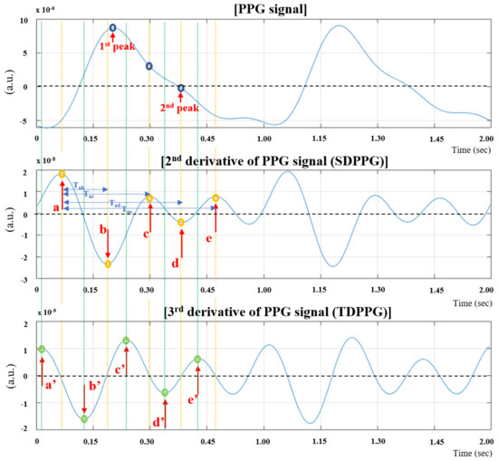 Age-Related Changes in the Characteristics of the Elderly Females Using the Signal Features of an Earlobe Photoplethysmogram
