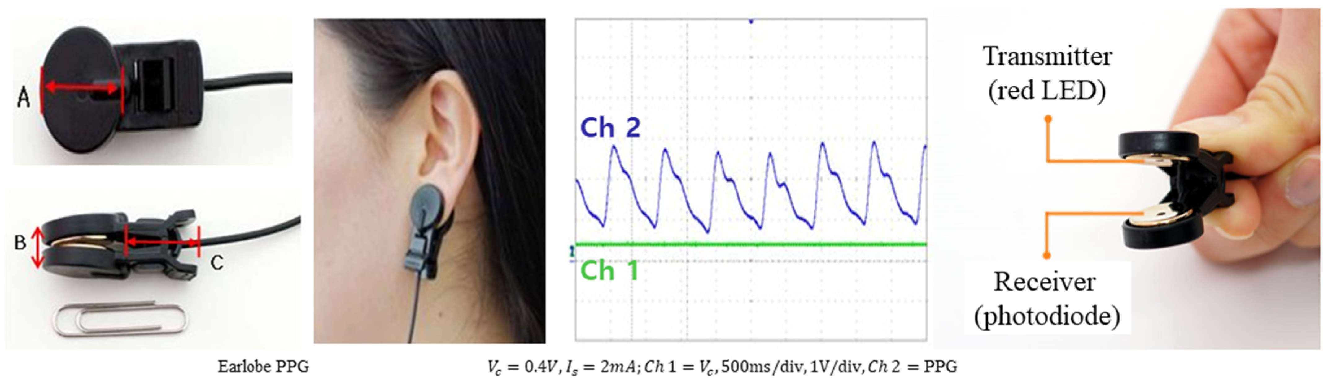 Association Between Cognitive Function and the Autonomic Nervous System by Photoplethysmography
